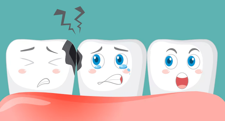 How a Broken Tooth Can Be Treated in an Emergency Situation