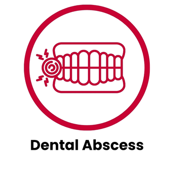 Dental Abscess