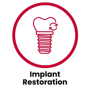 Implant restoration
