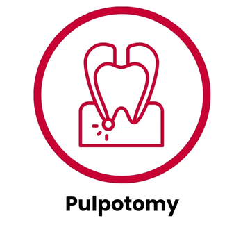 Pulpotomy