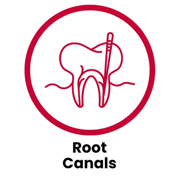 Root canals