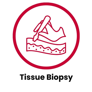 Tissue Biopsy