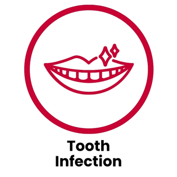 Tooth Infection