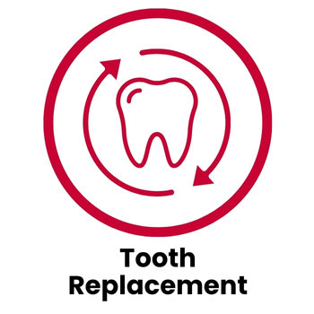 Tooth Replacement